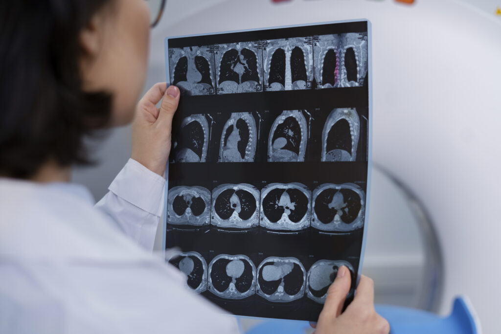 doctor-looking-ct-scan